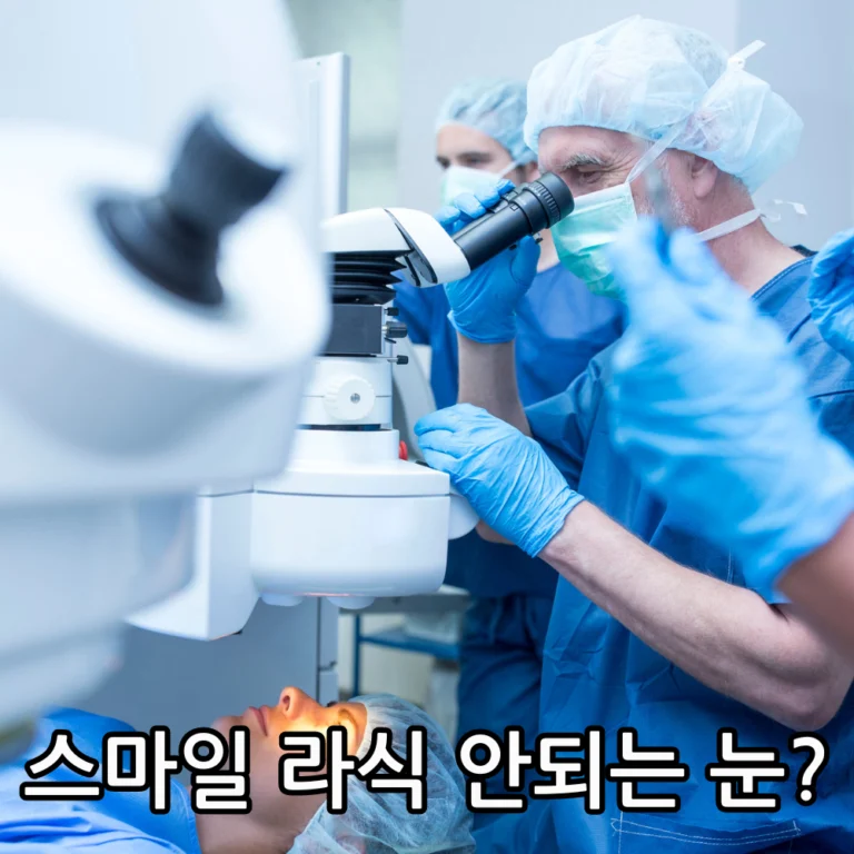 스마일 라식 안되는 눈 관련 썸네일