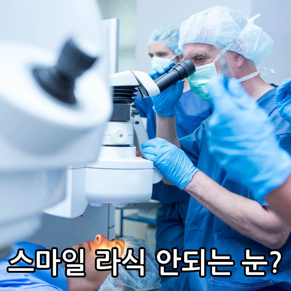 스마일 라식 안되는 눈 관련 썸네일
