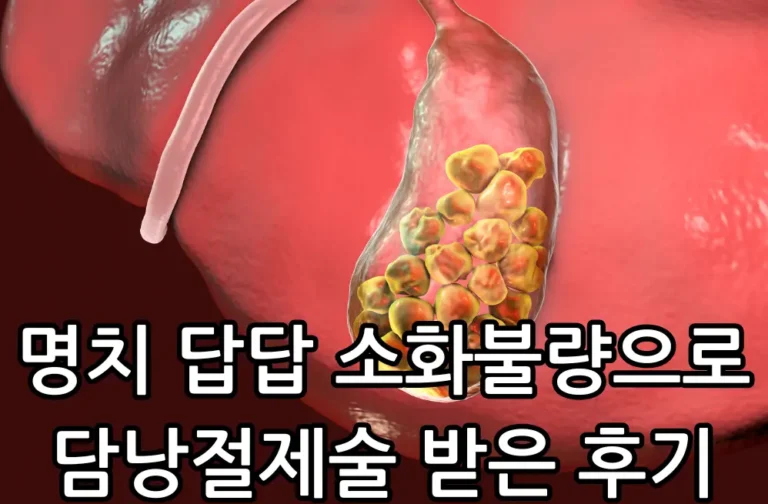 명치 답답 소화불량 관련 썸네일